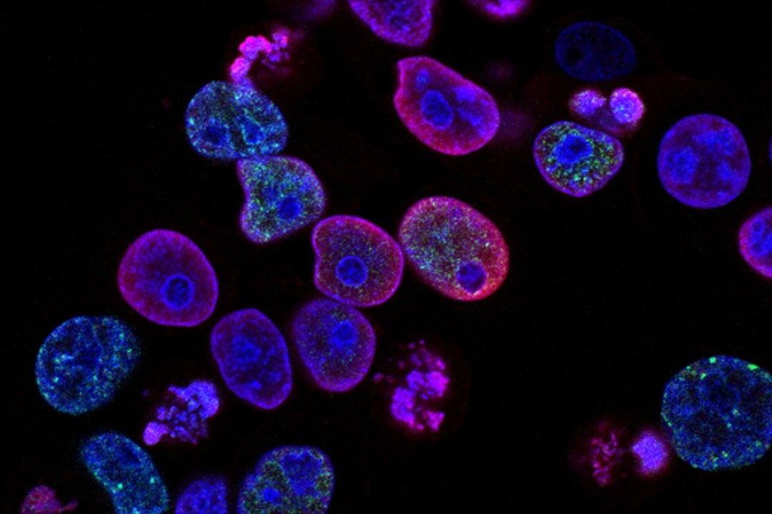 Cells under microscope