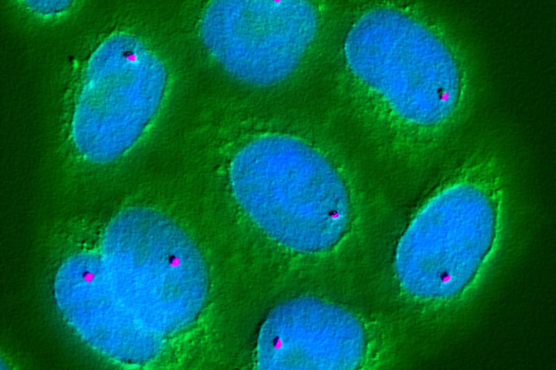 Cells under microscope