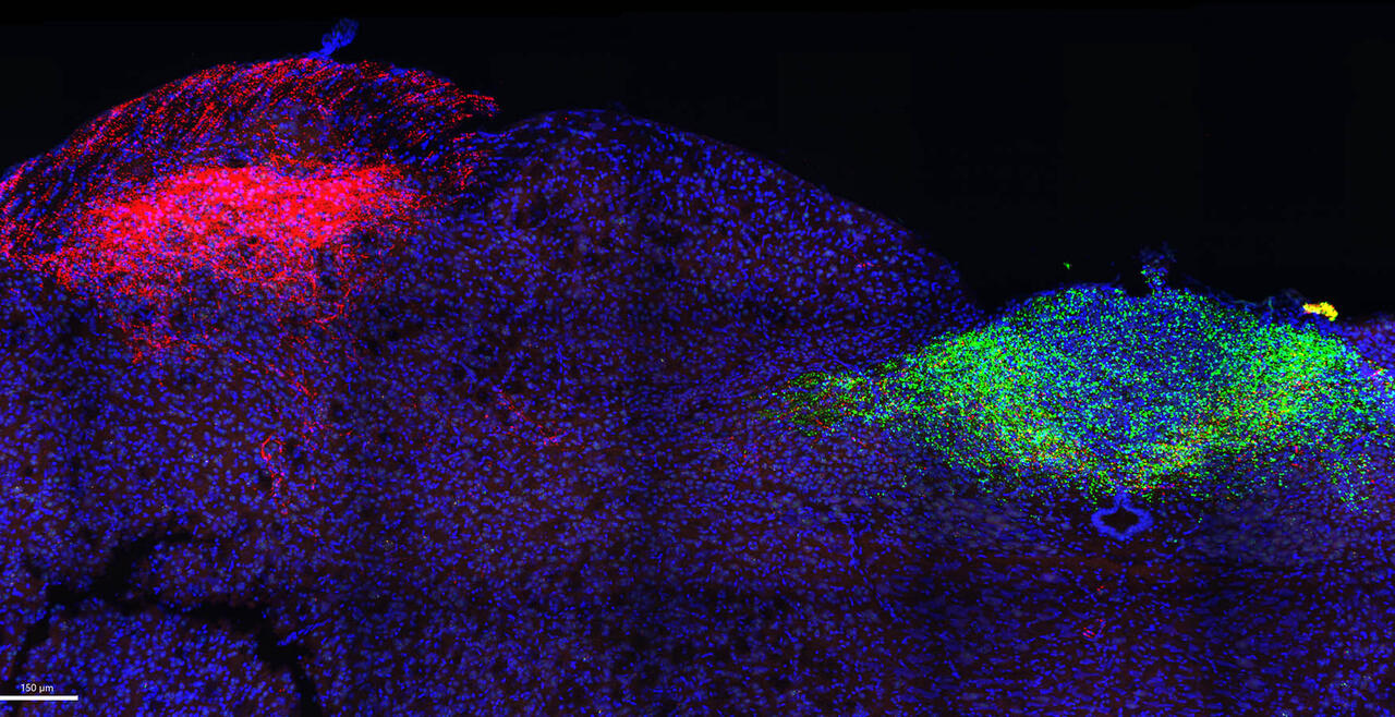 Brainstem projections of nodose TRPV1+ fibers to the nucleus tractus solitarius (green) and jugular TRPV1+ fibers to the paratrigeminal complex (red)