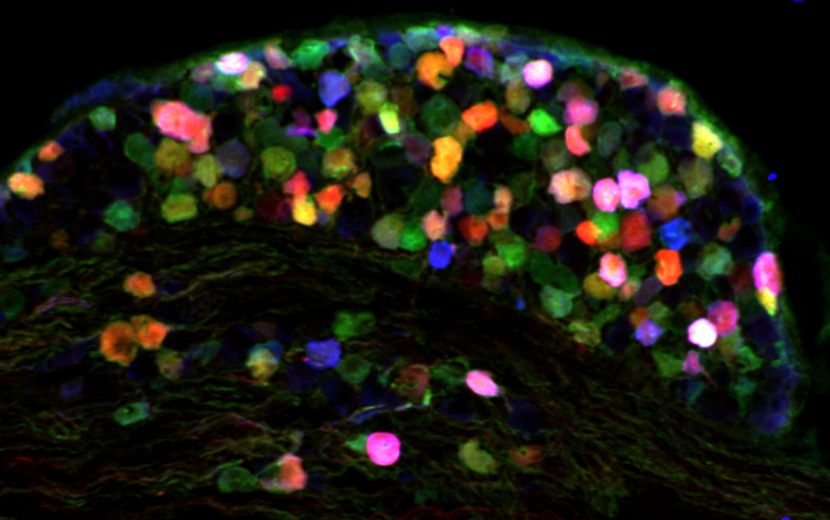 Vagal ganglion labeled with viruses that evoke rainbow fluorescence in nociceptive neurons
